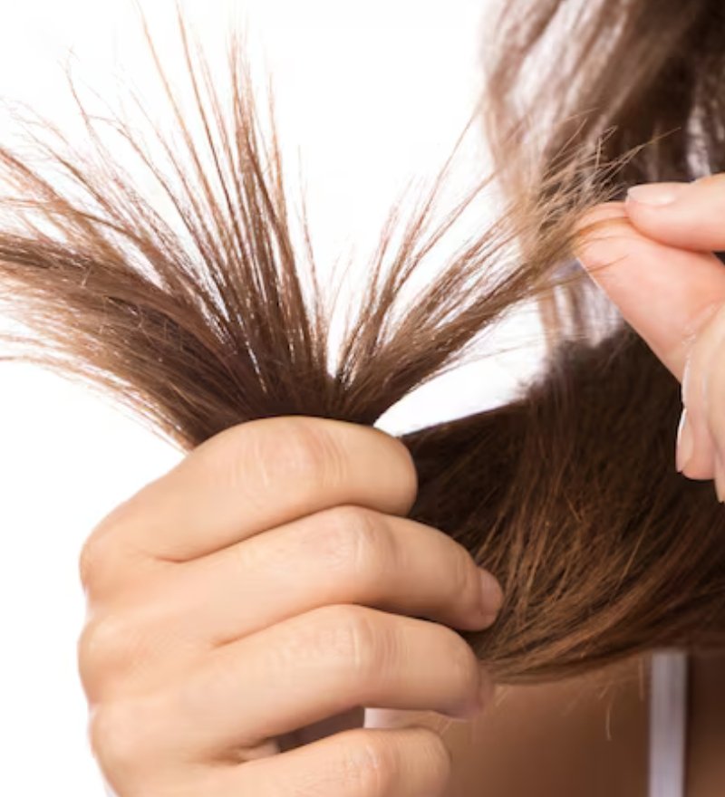 Bipolar Hair Treatment in Kaithal