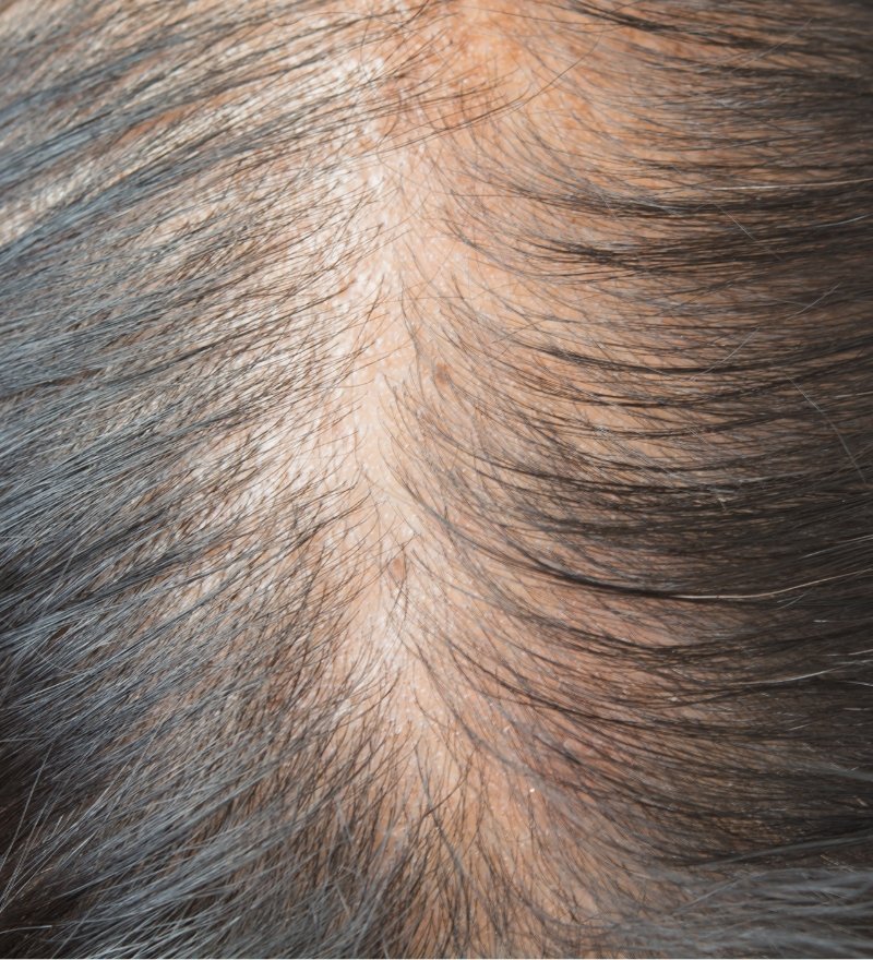 Miniaturization Treatment in Kaithal