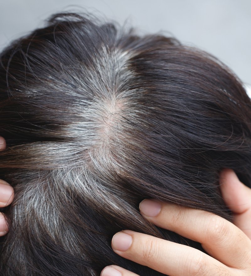 Premature Greying Treatment in Kaithal