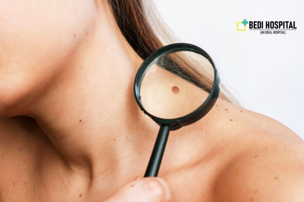 best skin treatment in Kaithal