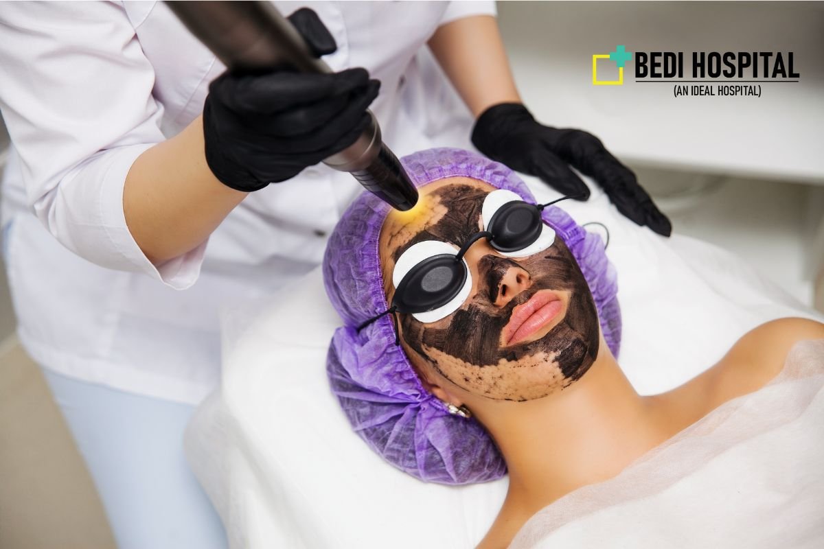 Carbon Laser Peel in Kaithal
